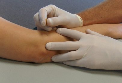 Dry needling and Instrument Assisted Soft Tissue Technique